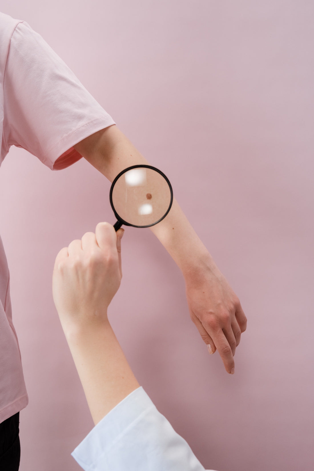 Melanomas - o que dizem os entendidos sobre o assunto?